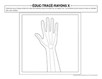 Éduc-tracé-Rayons X